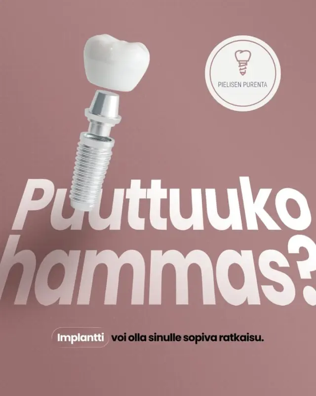 Puuttuuko hammas? Implantti voi olla ratkaisu.🦷

Hammasimplantti eli keinojuuri on titaaninen juuri, joka asennetaan leukaluuhun puuttuvan hampaan tilalle. Sen päälle valmistetaan yksilöllinen kruunu tai muu rakenne, joka näyttää ja tuntuu luonnolliselta.

Toimenpide tehdään paikallispuudutuksessa. Ennen hoitoa tutkimme tilanteen huolellisesti ja varmistamme, että leukaluuta on riittävästi. Asennuksen jälkeen keinojuuren annetaan luutua rauhassa ennen pysyvän hampaan kiinnitystä.

Implantti ei reikiinny, mutta huolellinen kotihoito on tärkeää, jotta lopputulos säilyy terveenä pitkään.

Mietitkö, olisiko tämä sinulle sopiva ratkaisu?
Varaa aika implanttikonsultaatioon.

👉 www.booking.assiscare.com/tyni/appointment
📞041 312 1393

#pielisenpurenta #hammasimplantti #suunterveys #Nurmes